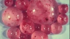 Какво е echinococcus и как да се справят с него